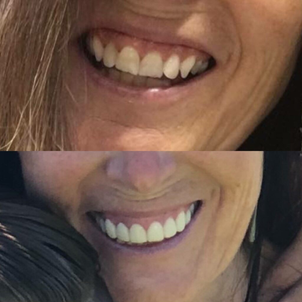 Smile Gallery. Dentist in Phoenix, AZ. Dr. Mike Hall. Hall Dental