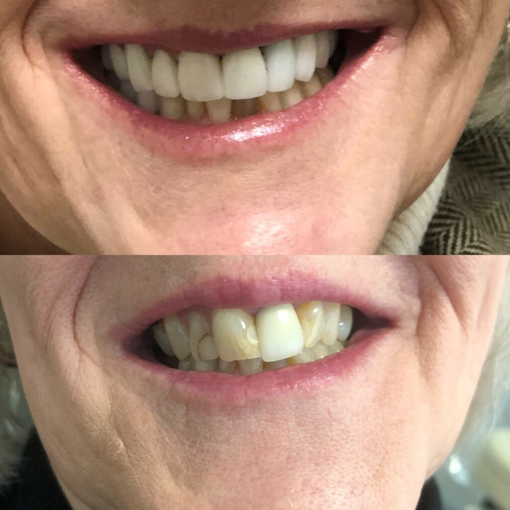 Smile Gallery. Dentist in Phoenix, AZ. Dr. Mike Hall. Hall Dental
